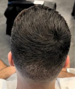 Voller Haaransatz nach Anwendung – Mann mit dichtem dunklem Haar von oben, Ergebnis mit CAVORIA Kaschierpuder