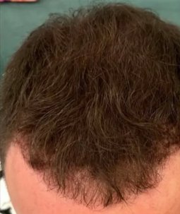 Dichtes lockiges Haar von oben – Nachher-Ergebnis mit CAVORIA Haar Kaschierpuder bei dunklem Haar