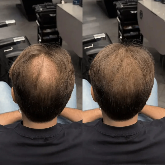 CAVORIA Haar Kaschierpuder Ergebnis beim Friseur – Vorher lichter Scheitel, Nachher volles hellbraunes Haar von hinten